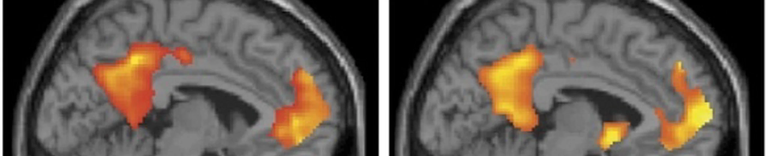 Neurologie du Temps
