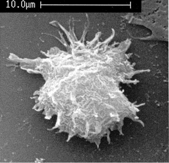 acanthamoeba