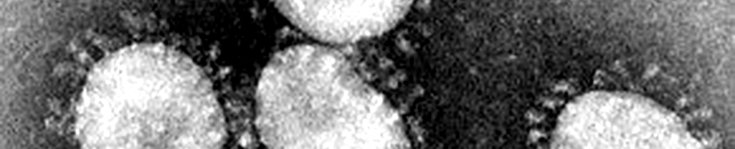 Pourquoi le coronavirus a-t-il cette forme de mine marine ?